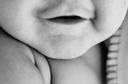 咽喉炎的早期症状有哪些？如何快速识别并有效缓解不适